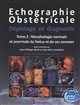 Échographie obstétricale : dépistage et diagnostic : Tome 2 : Morphologie normale et anormale du foetus et de ses annexes