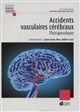 Accidents vasculaires cérébraux : thérapeutique