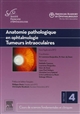 Cours de sciences fondamentales et cliniques : Section 4, 2011-2012 : Anatomie pathologique en ophtalmologie : Tumeurs intraoculaires
