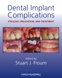 Dental implant complications : etiology, prevention, and treatment