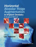 Horizontal alveolar ridge augmentation in implant dentistry : a surgical manual