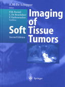 Imaging of soft tissue tumors