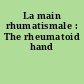 La main rhumatismale : The rheumatoid hand
