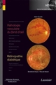 Pathologie vasculaire du fond d'oeil (en dehors du diabète)