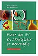 Place des IEC en cardiologie et neurologie : questions-réponses