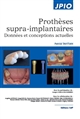 Prothèses supra-implantaires : données et conceptions actuelles