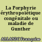 La Porphyrie érythropoïétique congénitale ou maladie de Gunther