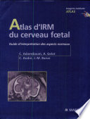 Atlas d'IRM du cerveau foetal : guide d'interprétation des aspects normaux