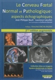 Le 	cerveau fœtal normal et pathologique : aspects échographiques