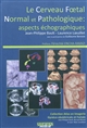 Le cerveau foetal normal et pathologique : aspects échographiques
