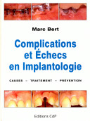 Complications et échecs en implantologie