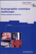 Scanographie volumique multicoupe : principes, applications, perspectives