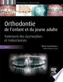 Orthodontie de l enfant et du jeune adulte : Tome 2 : traitement des dysmorphies et malocclusions