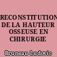 RECONSTITUTION DE LA HAUTEUR OSSEUSE EN CHIRURGIE PREPROTHETIQUE