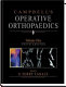 Campbell's operative orthopaedics