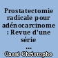 Prostatectomie radicale pour adénocarcinome : Revue d'une série de 123 cas