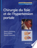 Chirurgie du foie et de l'hypertension portale