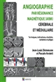 Angiographie par résonnance magnétique (ARM) cérébrale et médullaire : techniques, indications, résultats, variantes et pièges