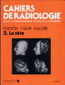Cahiers de radiologie : 2 : La tête