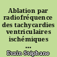 Ablation par radiofréquence des tachycardies ventriculaires ischémiques à l'aide du système Carto au CHU de Nantes