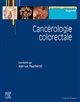 Cancérologie colorectale
