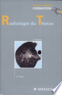 Radiologie du thorax