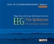 The epilepsies, EEG and epileptic syndromes