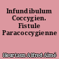 Infundibulum Coccygien. Fistule Paracoccygienne