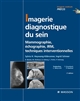 Imagerie diagnostique du sein : mammographie, échographie, IRM, techniques interventionnelles
