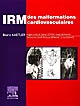 IRM des malformations cardiovasculaires