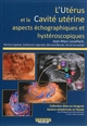 L'utérus et la cavité utérine : aspects échographiques et hystéroscopiques