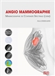 Angio-mammographie : mammographie de contraste spectrale (CESM)