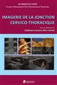 Imagerie de la jonction cervico-thoracique