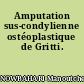 Amputation sus-condylienne ostéoplastique de Gritti.