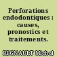 Perforations endodontiques : causes, pronostics et traitements.