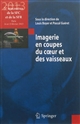 Imagerie en coupes du coeur et des vaisseaux : compte rendu des 5es Rencontres de la SFC et de la SFR, Paris, 14 et 15 février 2013