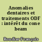 Anomalies dentaires et traitements ODF : intérêt du cone beam