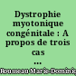Dystrophie myotonique congénitale : A propos de trois cas au Centre hospitalier de la Roche sur Yon