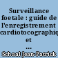 Surveillance foetale : guide de l'enregistrement cardiotocographique et des autres moyens de surveillance du foetus