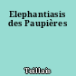 Elephantiasis des Paupières
