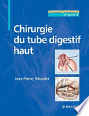 Chirurgie du tube digestif haut