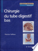 Chirurgie du tube digestif bas