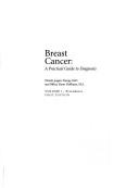 Breast cancer : a practical guide to diagnosis